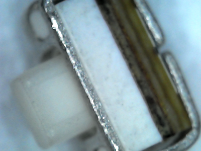  Détail du bouton au microscope, vue de dessus